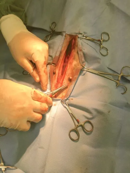 surgical field during pyometra surgery
