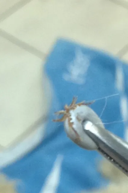 An Ixodes tick beiung held with forceps 