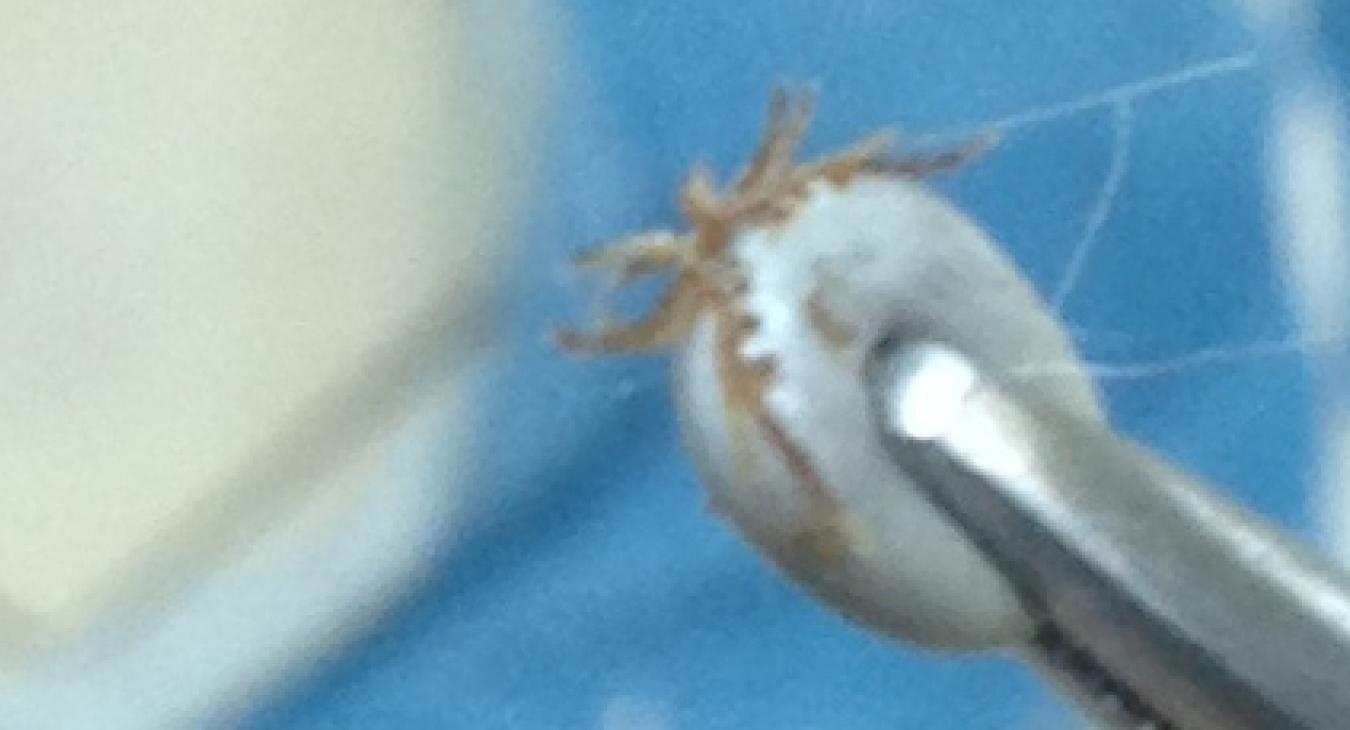 An Ixodes tick beiung held with forceps 