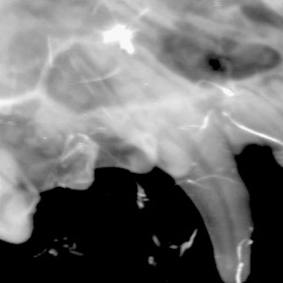 a canine tooth on xray